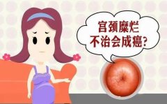 t(y)ίmiӠô