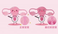 miӠô